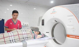 'Nuốt không trôi', biểu hiện không thể ngờ của bệnh đột quỵ dễ bị bỏ qua