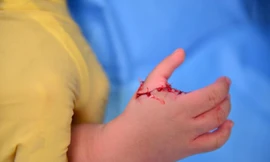 'Phù thủy bàn tay' người Pháp mang phép mầu cho hàng chục trẻ khuyết tật Việt Nam