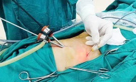 Người phụ nữ mất túi mật vì tự 'bắt bệnh'