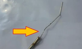 Cậu bé 10 tuổi tự nhét que sắt và thỏi nam châm vào dương vật