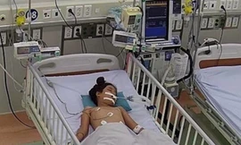 Bé gái nguy kịch vì bị rắn độc cắn nhưng lại nhờ thày lang 'hút nọc độc'