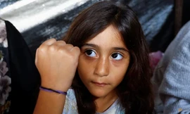  Con gái anh Ali Daba được bố mẹ đeo vòng tay để phòng nguy cơ thiệt mạng trong bom đạn. (Ảnh: Reuters) 