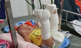 Bé trai bị bố bạo hành chấn thương nặng.