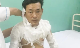 Vụ 9X tẩm xăng lên người để cướp ngân hàng: Nhân viên bí mật nhấn chuông báo động