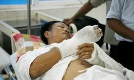 Côn đồ xông vào trụ sở chém công an