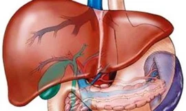 Tám triệu người Việt Nam nhiễm vi-rút viêm gan B hoặc C