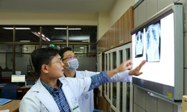 Người phụ nữ Hà Nội mang khối u 4 kg, chèn 'bẹp dí' phổi, đẩy tim chạy ngược lên trên