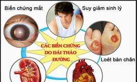 Biến chứng kép tim mạch – võng mạc ở bệnh nhân tiểu đường: Có thể ngăn chặn từ sớm