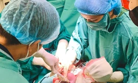 Hi hữu, 2 em bé chào đời cùng vòng tránh thai