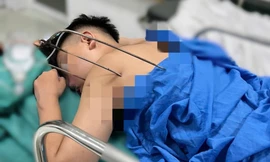 Nam sinh 17 tuổi bị cây đinh ba đâm xuyên tim phổi thoát chết kì diệu 