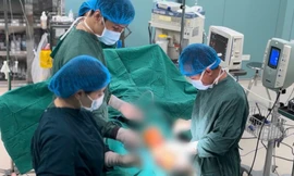 236 ca tử vong, gần 29.000 người nhập viện trong ngày đầu nghỉ lễ 