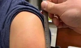 Vắc xin Moderna và phản ứng 'cánh tay COVID'