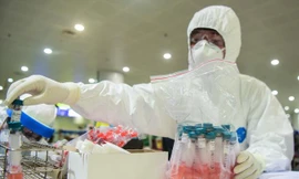 Chuyên gia nói về nguy cơ lây lan virus của ca tái nhiễm SARS-CoV-2 tại Hà Nội