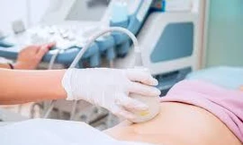 Hi hữu, người phụ nữ Hà Nội mang thai ở đại tràng