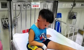 Cấp cứu bé 3,5 tuổi chấn thương đầu mặt cổ, bị cho vào thùng giấy, nhốt trong tủ cấp đông