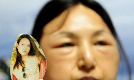 Tham phẫu thuật rẻ, thiếu nữ biến thành bà già