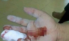 Tin nóng 24H: Bị rách tay, nam thanh niên được bác sĩ chỉ định khâu... âm đạo