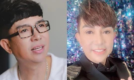 Hình ảnh trước và sau phẫu thuật thẩm mỹ của Long Nhật.