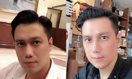 Vì sao Việt Anh vội vàng phẫu thuật thẩm mỹ ngay sau khi ly hôn?