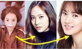 Quế Vân gây sốc khi chi 200 triệu phẫu thuật mũi giống Song Hye Kyo