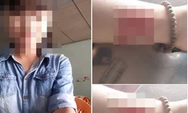 Rợn người trước những chiêu hành xác sau khi chia tay của giới trẻ