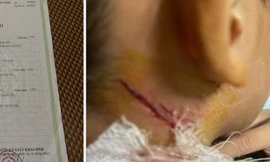 Diễn biến mới vụ bé trai 11 tuổi nghi bị hành hạ khi câu cá ở ao hàng xóm