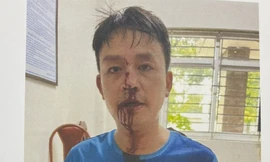 Hà Nội: Ngày mai, xét xử nhóm côn đồ đánh người ‘hội đồng’ tại chung cư Osaka Complex 