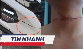 TIN NHANH 12H: Chuyên gia nói về sáp nhập quận Hoàn Kiếm; Dây diều cứa ngang cổ người, chém đầu ô tô