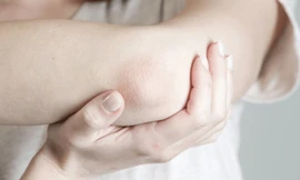 Vì sao bác sỹ khuyên chúng ta nên chú ý bảo vệ khuỷu tay? 