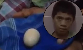 Cậu bé biết "đẻ" trứng ở Indonesia. 