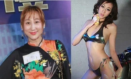 Phát hoảng với gương mặt biến dạng của vợ tài tử ‘Thiên Long Bát Bộ’