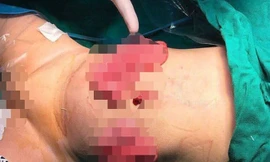 Bản tin 8H: Kinh hãi, mẹ dùng dao đâm vào bụng con 11 tháng tuổi