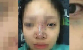 Bản tin 14H: Chủ spa tiêm filler cho sinh viên suýt mù mắt bỏ trốn