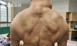 Ông Tan bị mắc bệnh hiếm vì nghiện rượu. Ảnh SCMP