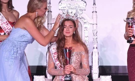 Nhan sắc cô gái mất thích giác đăng quang Hoa hậu Anh 2018