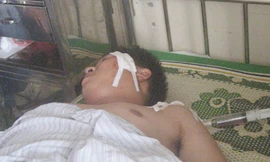 Côn đồ truy sát đối thủ, chém cảnh sát hình sự