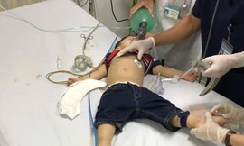 Bé trai 22 tháng tuổi ngưng tim, ngưng thở vì hóc thạch rau câu