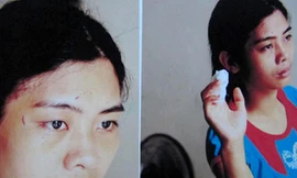 Chị Duyên với những vết thương sau khi bị cô em chồng đánh đập