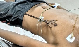 Bệnh nhân Nguyễn Phúc Duy lúc mới nhập viện.