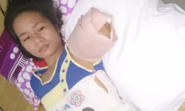 Tham quan vườn thú, một phụ nữ bị hổ vồ mất cánh tay