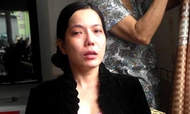 Tình tiết mới vụ nữ phó phòng đập xe Chủ tịch tỉnh