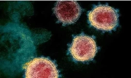 Nếu virus SARS-CoV-2 xâm nhập trực tiếp vào não, khả năng tử vong cao hơn.