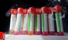 Tăm bông đổi màu tại phòng thí nghiệm khiến Israel tạm dừng xét gnhiệm COVID-19 toàn quốc.