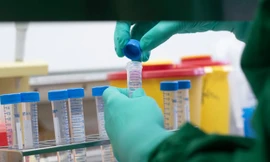 Các công bố về nghiên cứu SARS- CoV-2 bị giới chức Trung Quốc kiểm soát chặt chẽ.