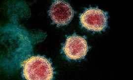 Phương pháp xét nghiệm nhằm vào 3 virus mục tiêu có thể cho kết quả sau 20 phút và chính xác 100 %