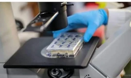 Các tế bào sản sinh kháng thể chống lại COVID-19 được đưa vào soi qua kính hiển vi.