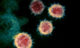 Chủng virus SARS= CoV-2 phát triển cả trong thời tiết lạnh giá lẫn nóng nực.