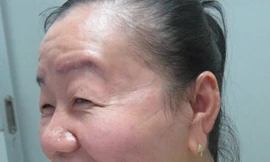 Gương mặt chị Phượng tiếp tục trẻ thêm