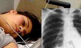 Nuốt điện thoại vào bụng vì sợ bạn trai đọc được tin nhắn