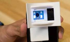 Chẩn đoán ung thư miệng bằng điện thoại